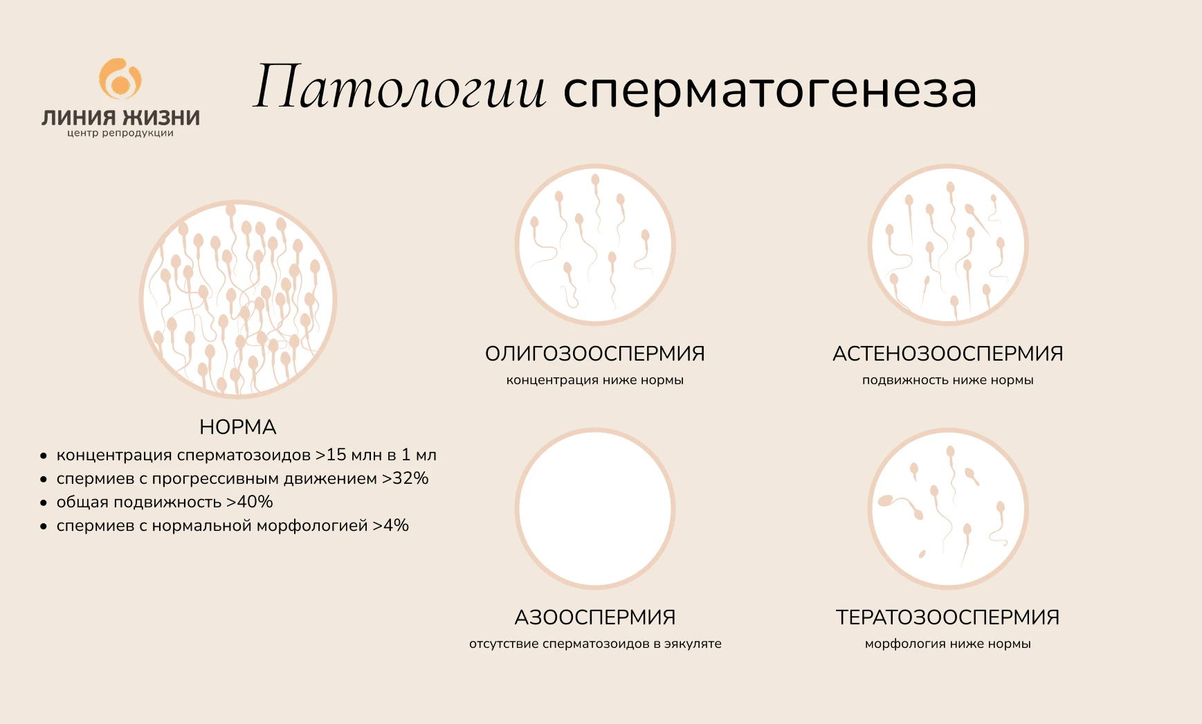 Патологии сперматогенеза.png