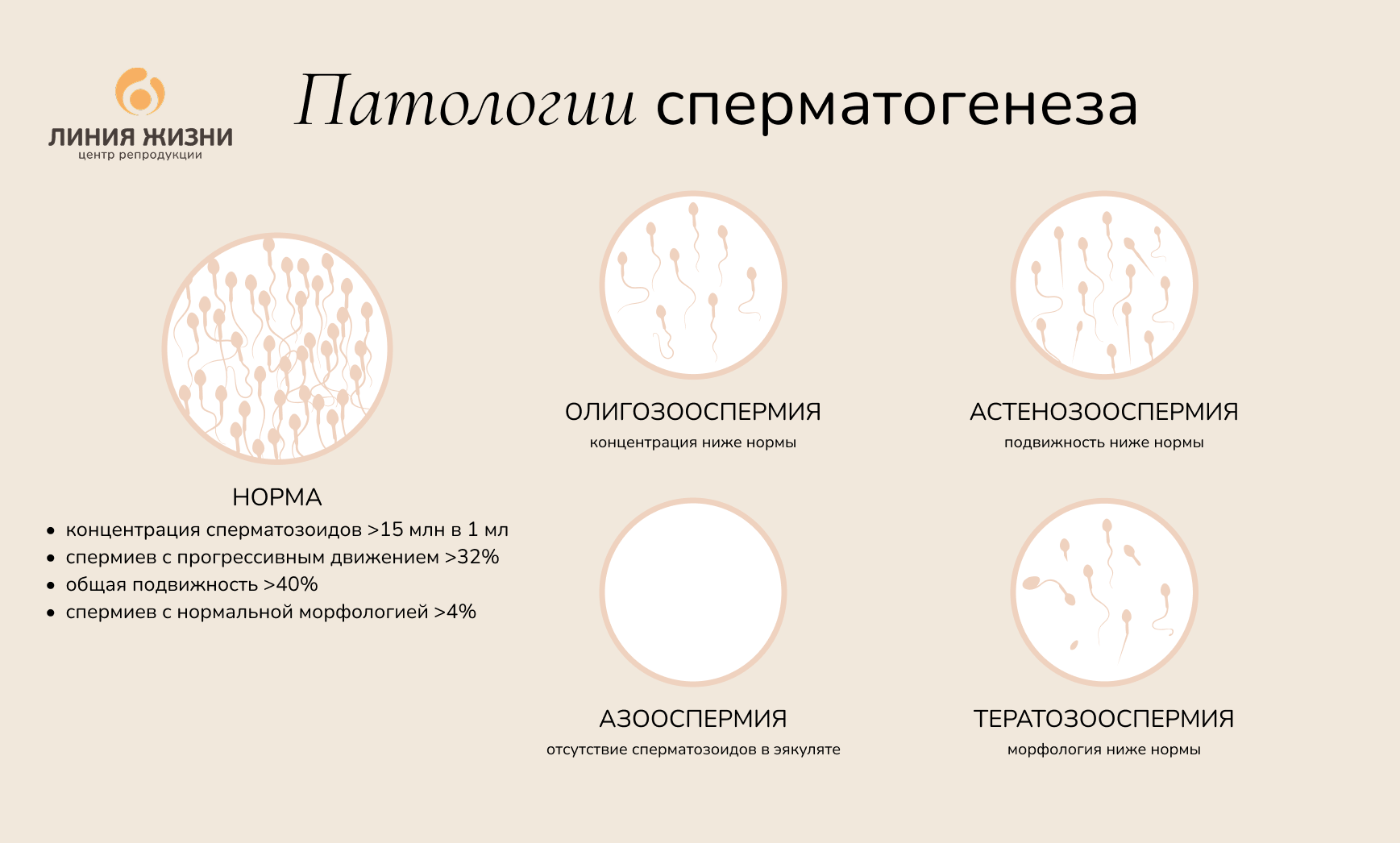 Патологии сперматогенеза.png