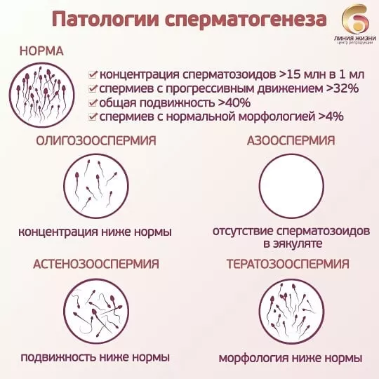 Лейкоциты в спермограмме